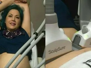 SculpSure