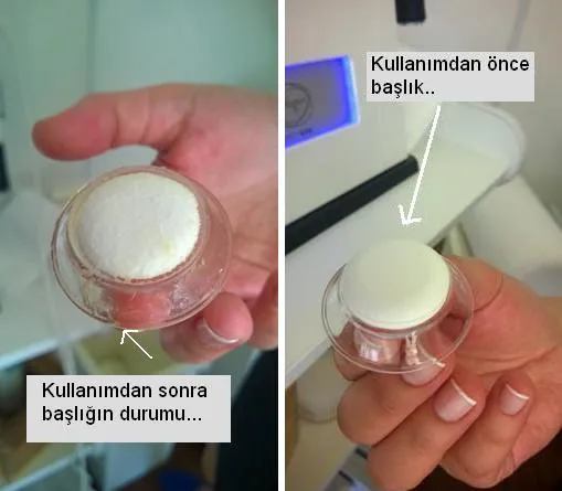 kapsulbaslangic